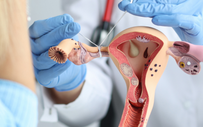 Tubal Ligation vs Hysterectomy: Exploring Permanent Sterilization Options